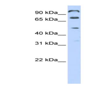 anti-Chromosome 10 Open Reading Frame 38 (C10ORF38) (Middle Region) antibody avatar