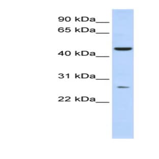 anti-Adenylate Kinase Domain Containing 1 (ADK1) (Middle Region) antibody avatar