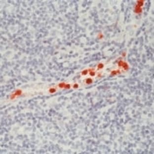 anti-CD16 Molecule (CD16) antibody avatar