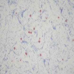 anti-CD16 Molecule (CD16) antibody avatar