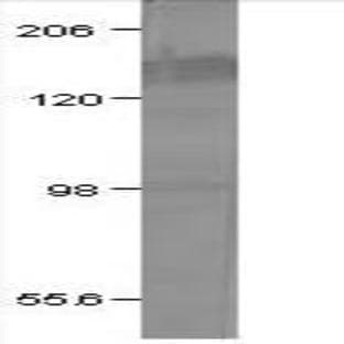 anti-Adenylate Cyclase 5 (ADCY5) (C-Term) antibody avatar