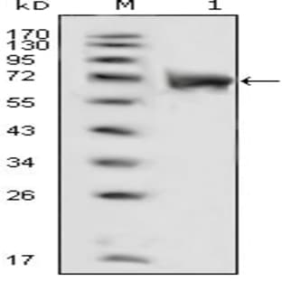 anti-Fibroblast Growth Factor Receptor 1 (FGFR1) (AA 22-376) antibody avatar