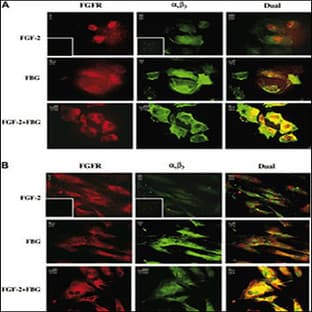 anti-Fibroblast Growth Factor Receptor 1 (FGFR1) (N-Term), (AA 19-48) antibody avatar