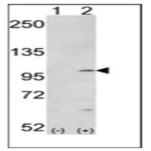 anti-Fibroblast Growth Factor Receptor 1 (FGFR1) (pTyr653), (pTyr654) antibody avatar