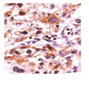 anti-Fibroblast Growth Factor Receptor 1 (FGFR1) (pTyr766) antibody avatar