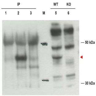 anti-Cytohesin 1 Interacting Protein (CYTIP) (C-Term) antibody avatar