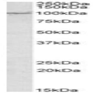anti-AAK1 (Internal Region) antibody avatar