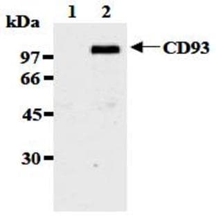anti-CD93 Molecule (CD93) antibody avatar