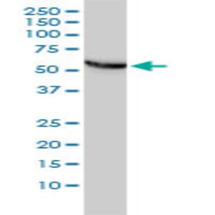 anti-Chaperonin Containing TCP1, Subunit 5 (Epsilon) (CCT5) (AA 1-542) antibody avatar