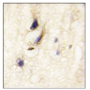 anti-Dishevelled Associated Activator of Morphogenesis 1 (DAAM1) (N-Term), (C-Term) antibody