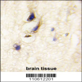 anti-Dishevelled Associated Activator of Morphogenesis 1 (DAAM1) (C-Term), (AA 1034-1063) antibody