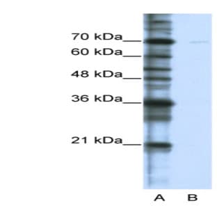 anti-Cleavage Stimulation Factor, 3' Pre-RNA, Subunit 2, 64kDa, tau Variant (CSTF2T) (C-Term) antibody avatar
