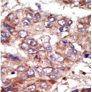 anti-Acyl-CoA Synthetase Long-Chain Family Member 6 (ACSL6) (Middle Region) antibody avatar