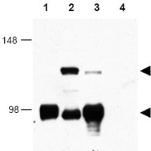 anti-CREB Regulated Transcription Coactivator 1 (CRTC1) (AA 19-34) antibody avatar