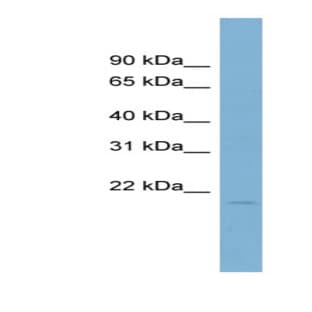 anti-Coactosin-Like Protein (N-Term) antibody avatar