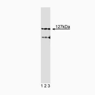 anti-Adaptor-Related Protein Complex 4, epsilon 1 Subunit (AP4E1) (AA 685-793) antibody avatar