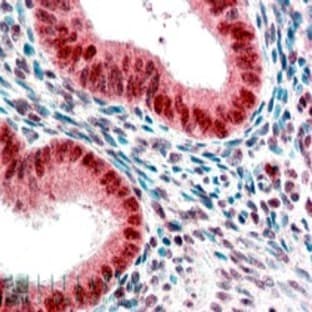 anti-Chromobox Homolog 5 (CBX5) (Internal Region) antibody avatar