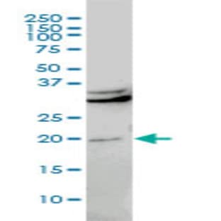 anti-Chromobox Homolog 5 (CBX5) (AA 1-192) antibody avatar