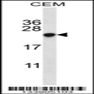 anti-Chromobox Homolog 5 (CBX5) (AA 88-117), (Center) antibody avatar