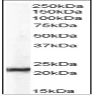 anti-Chromobox Homolog 5 (CBX5) (Internal Region) antibody avatar