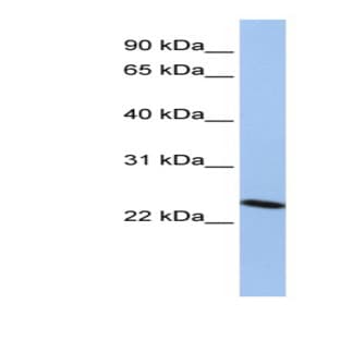 anti-Chromobox Homolog 7 (CBX7) (Middle Region) antibody avatar