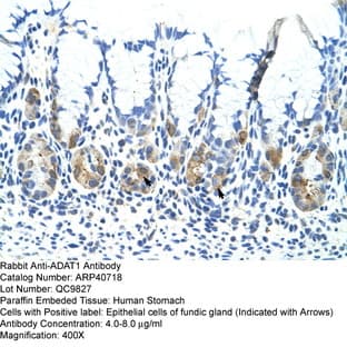 anti-Adenosine Deaminase, tRNA-Specific 1 (ADAT1) (C-Term) antibody avatar
