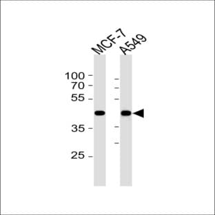 anti-Cyclin-Dependent Kinase 20 (CDK20) (N-Term) antibody avatar