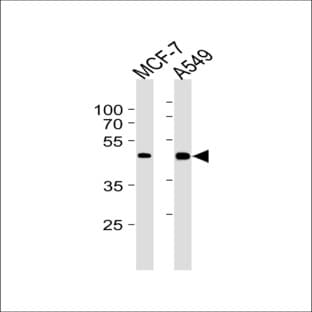anti-Cyclin-Dependent Kinase 20 (CDK20) (N-Term) antibody avatar