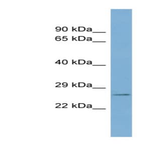 anti-WW Domain Binding Protein 2 (WBP2) (N-Term) antibody avatar