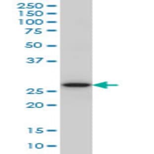 anti-Caspase 14, Apoptosis-Related Cysteine Peptidase (CASP14) (AA 133-243) antibody avatar