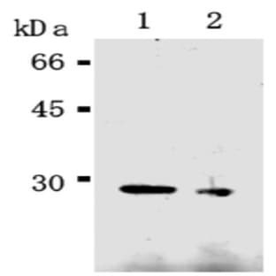 anti-Caspase 14, Apoptosis-Related Cysteine Peptidase (CASP14) antibody avatar