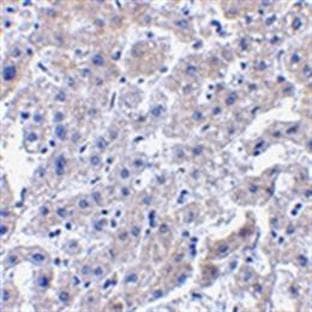 anti-Caspase 14, Apoptosis-Related Cysteine Peptidase (CASP14) (C-Term) antibody avatar