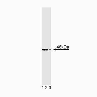 anti-Cyclin D-Type Binding-Protein 1 (CCNDBP1) (AA 62-277) antibody avatar