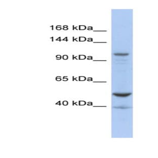 anti-DEAD (Asp-Glu-Ala-Asp) Box Polypeptide 58 (DDX58) (Middle Region) antibody avatar