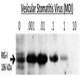 anti-DEAD (Asp-Glu-Ala-Asp) Box Polypeptide 58 (DDX58) (C-Term) antibody avatar