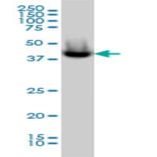 anti-Acyl-CoA Thioesterase 9 (Acot9) (AA 1-213) antibody avatar