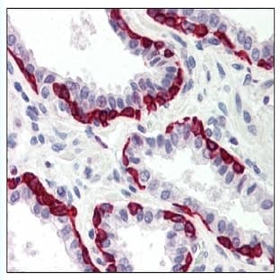 anti-Death-Associated Protein Kinase 2 (DAPK2) (C-Term) antibody avatar