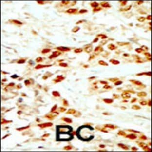 anti-Death-Associated Protein Kinase 2 (DAPK2) (N-Term), (AA 40-70) antibody avatar