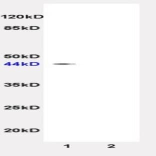 anti-Cell Adhesion Molecule 1 (CADM1) antibody avatar