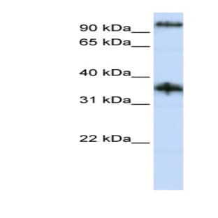 anti-Chromosome 9 Open Reading Frame 4 (C9orf4) (N-Term) antibody avatar