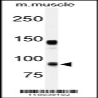 anti-ADAM Metallopeptidase with thrombospondin Type 1 Motif, 5 (ADAMTS5) (AA 331-360), (Center) antibody avatar