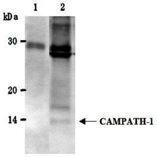 anti-CD52 Molecule (CD52) antibody avatar