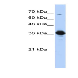 anti-ATPase, H+ Transporting, Lysosomal 38kDa, V0 Subunit D2 (ATP6V0D2) (Middle Region) antibody avatar