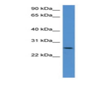 anti-Chondrolectin (CHODL) (C-Term) antibody avatar