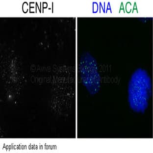 anti-Centromere Protein I (CENPI) (N-Term) antibody avatar