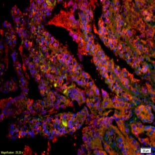 anti-CD8a Molecule (CD8A) antibody