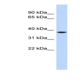 anti-Chromosome 22 Open Reading Frame 30 (C22orf30) (Middle Region) antibody avatar