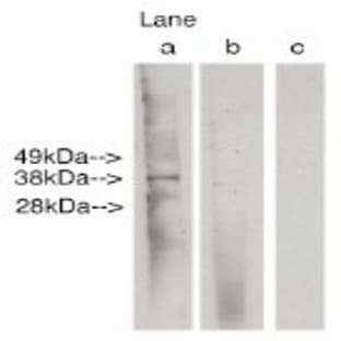 anti-Ceramide Synthase 6 (CERS6) antibody avatar