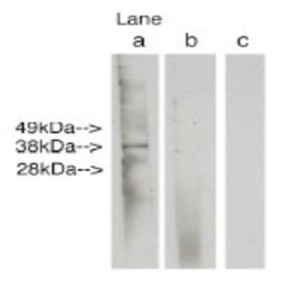 anti-Ceramide Synthase 6 (CERS6) antibody avatar