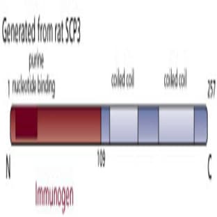 anti-CTD Small Phosphatase-Like Protein (CTDSPL) (AA 1-109) antibody avatar